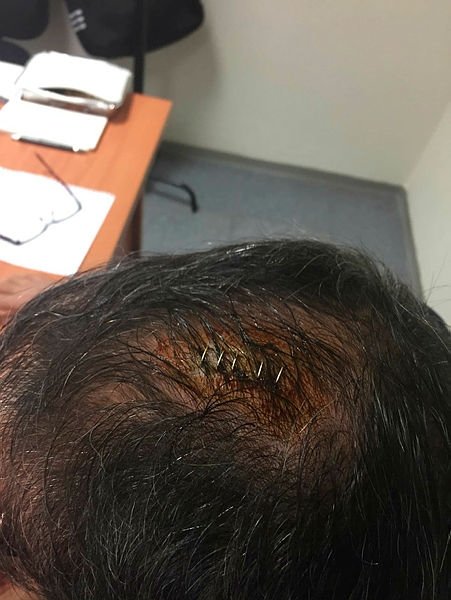 Şenol Güneş’in doktoru konuştu