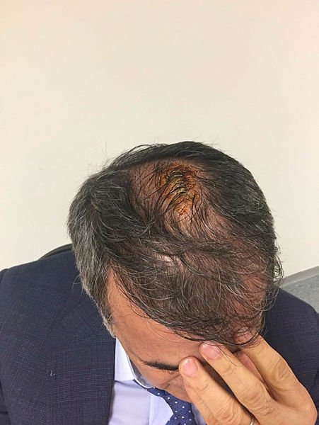 Şenol Güneş’in doktoru konuştu