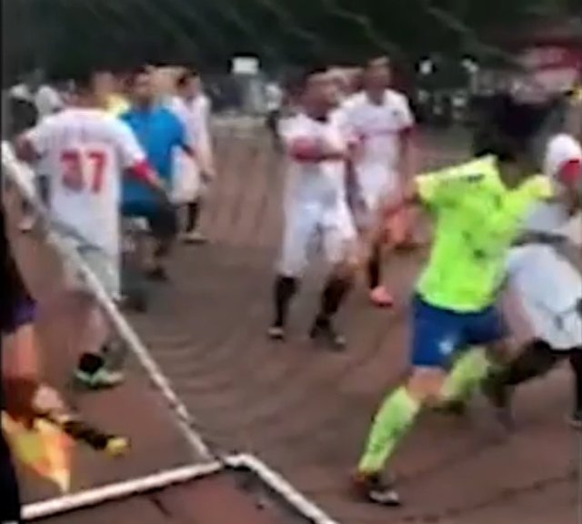 Çin’de akılalmaz olay! Rakibinin kulağını kopardı...