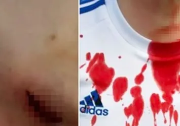 Futbol terörü! Boğazını bıçakla kesti!