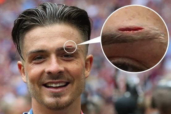 Paramparça kramponlarla Premier Lig’e...