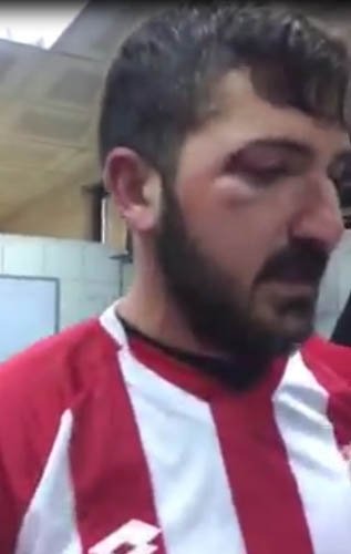 Futbolcuları hastanelik ettiler!