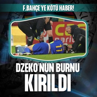 Dzeko’nun burnu kırıldı! Fenerbahçe...