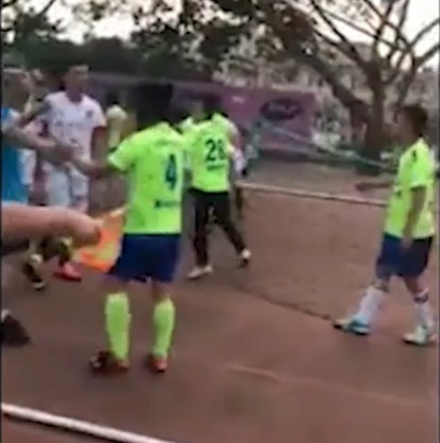 Çin’de akılalmaz olay! Rakibinin kulağını kopardı...