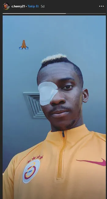 Onyekuru gözünün son halini paylaştı - 1