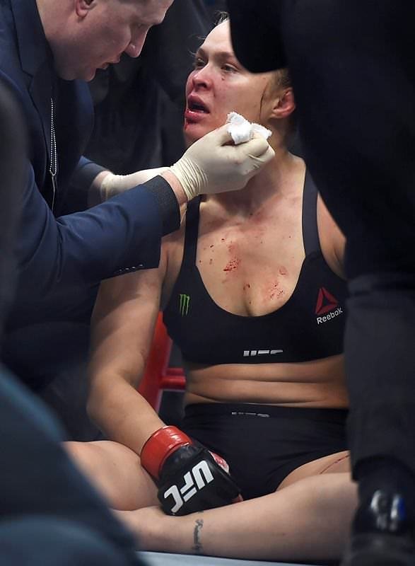 Hırçın kız hastanelik oldu