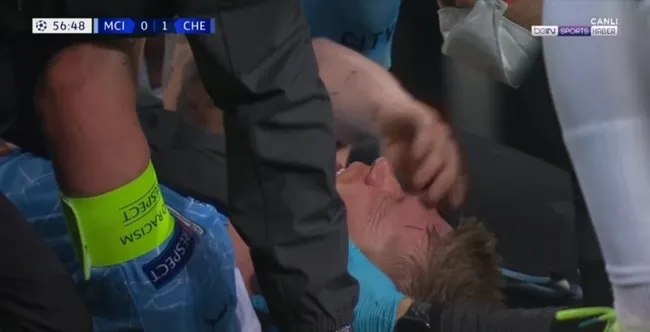 Son dakika spor haberleri: Manchester City Chelsea maçında şok sakatlık! Kevin De Bruyne... - 2
