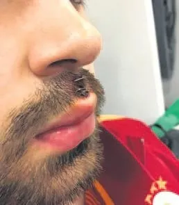 Faty'nin Ahmet Çalık'a tekmesi sonrası şoke eden görüntü - 1