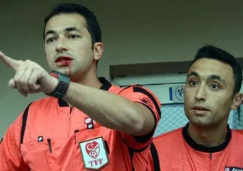 Sonunda buda oldu! Hakeme kafa attı...