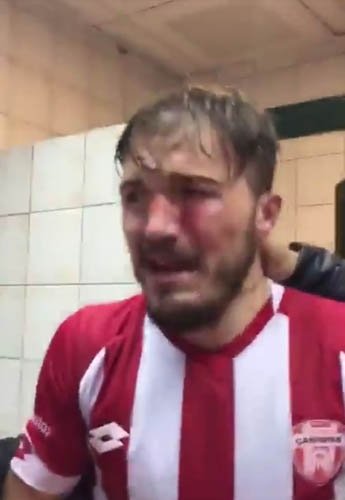 Futbolcuları hastanelik ettiler!