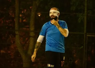 Burnu kırılan Berkay, maskeyle maça çıktı