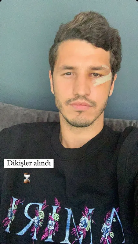 Salih Uçan'ın yüzündeki dikişler alındı - 1