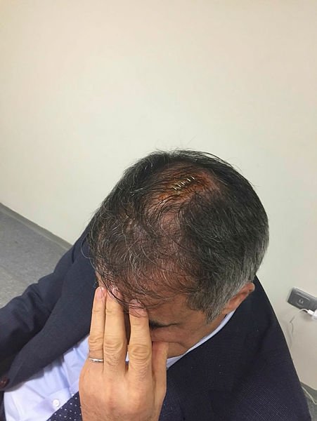 Şenol Güneş’in doktoru konuştu