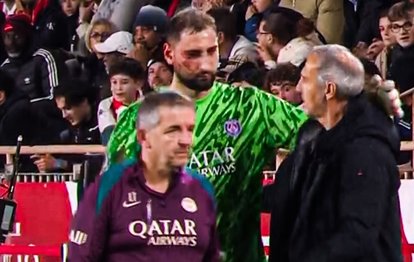 Donnarumma korkuttu! Yanağına dikiş atıldı, oyundan çıkmak zorunda kaldı