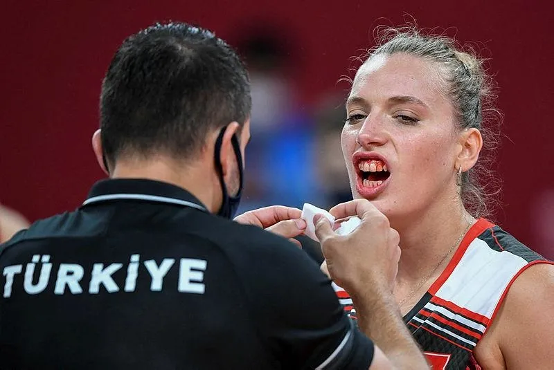 Türkiye-Rusya voleybol maçında korkutan anlar! Meliha İsmailoğlu ile Cansu Özbay çarpıştı - 3