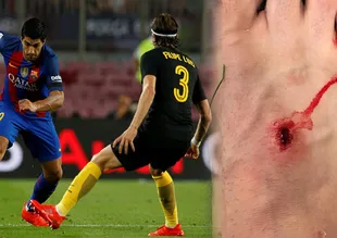 Barcelona – Atletico Madrid maçında Suarez, Felipe Luis’in ayağını deldi!