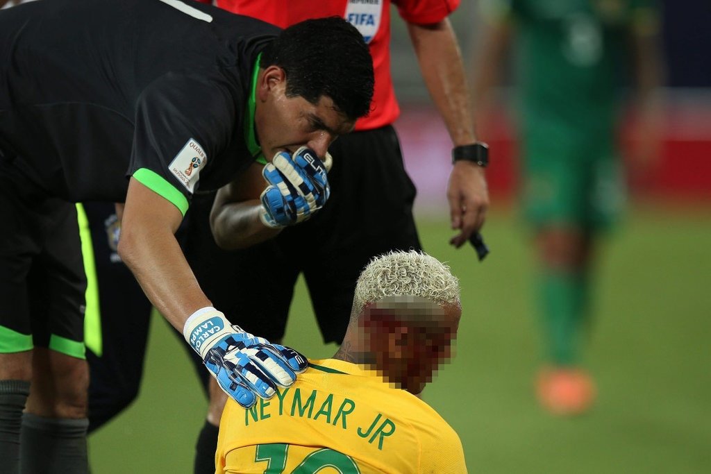 Neymar ölümden döndü! O anlar...