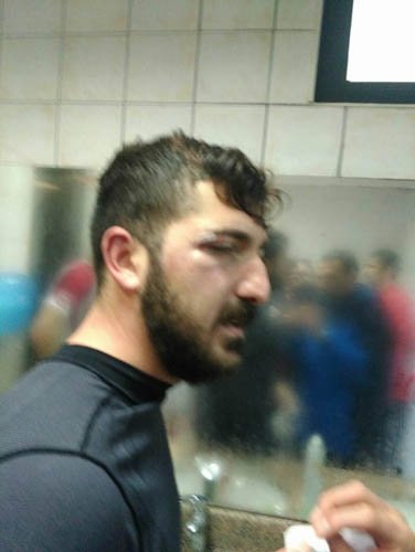 Futbolcuları hastanelik ettiler!