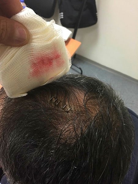 Şenol Güneş’in doktoru konuştu