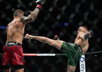 Conor McGregor'un ayağı kırıldı!