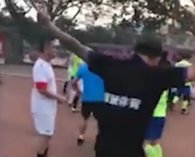 Çin’de akılalmaz olay! Rakibinin kulağını kopardı...