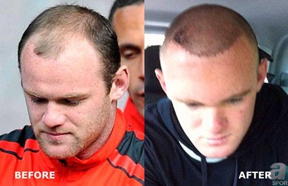 Mateja Kezman’ın inanılmaz değişimi! Görenler gözlerine inanamadı