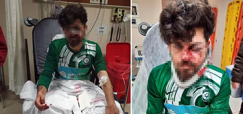 Kırmızı kart gören amatör futbolcu yerde yatan rakibinin yüzüne tekme attı!