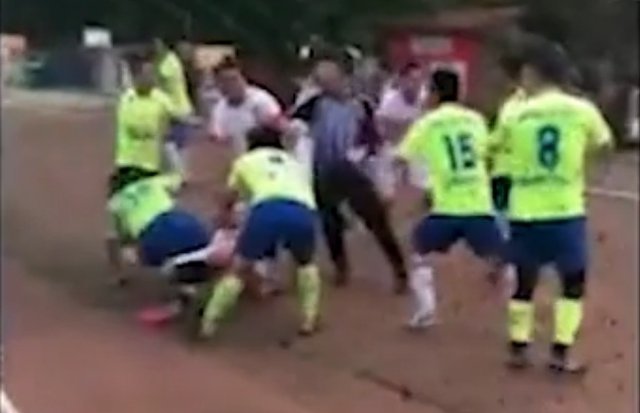 Çin’de akılalmaz olay! Rakibinin kulağını kopardı...