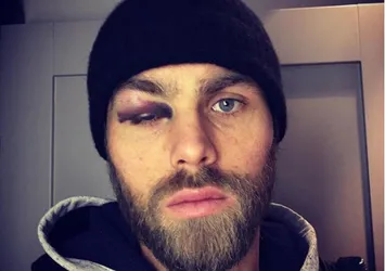 Elmander'in son hali şoke etti!