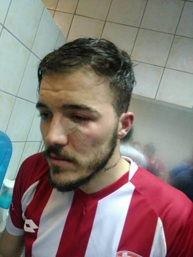 Futbolcuları hastanelik ettiler!