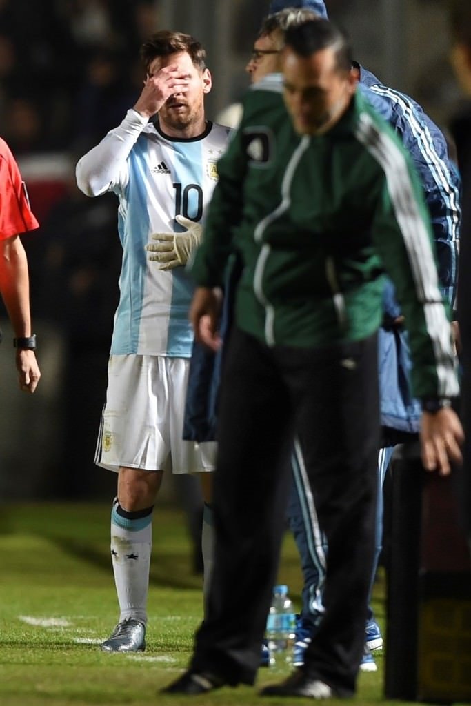 Messi milli maçta sakatlandı